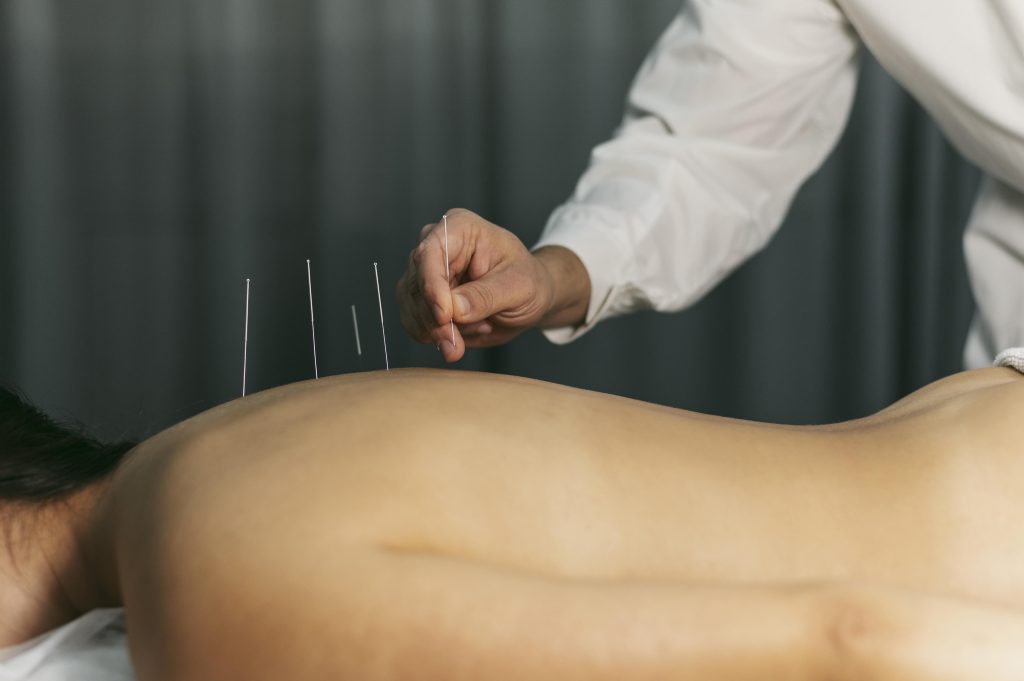 Acupuncturist in harderwijk